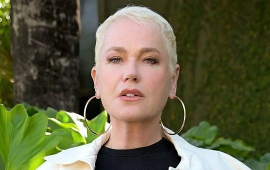 Xuxa recebe alta após cirurgia minimamente invasiva na coluna