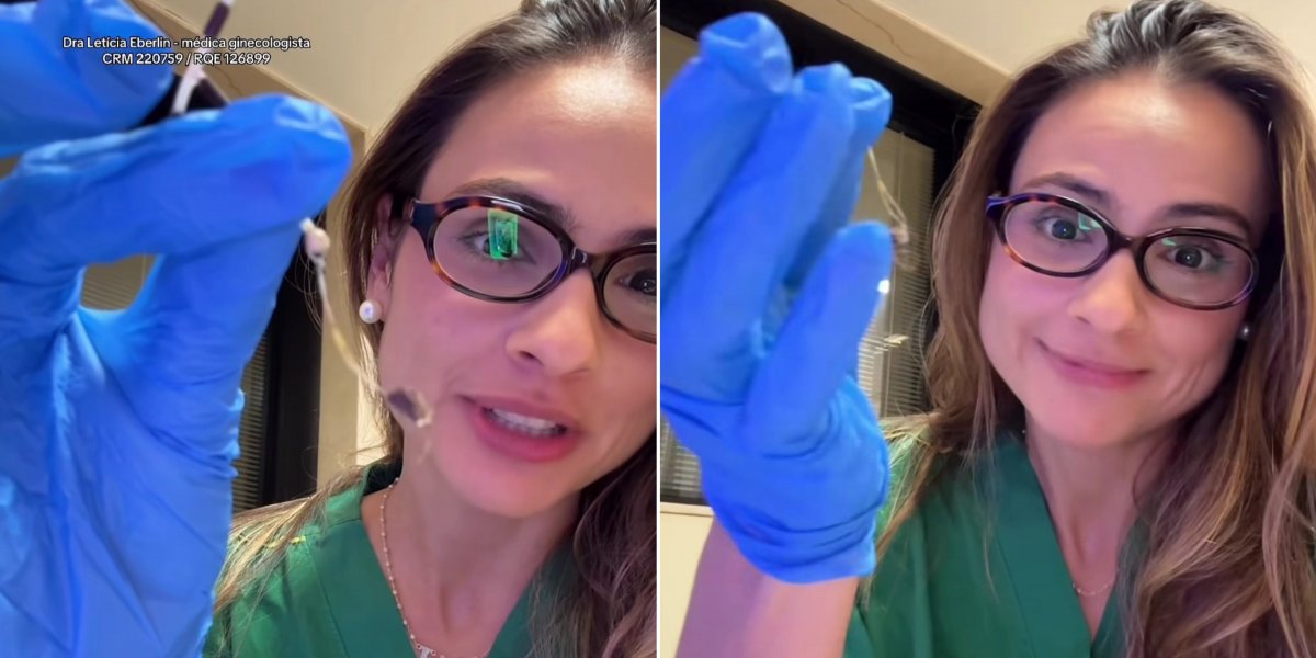 Ginecologista surpreende ao mostrar pelos de gatos enrolados em DIU