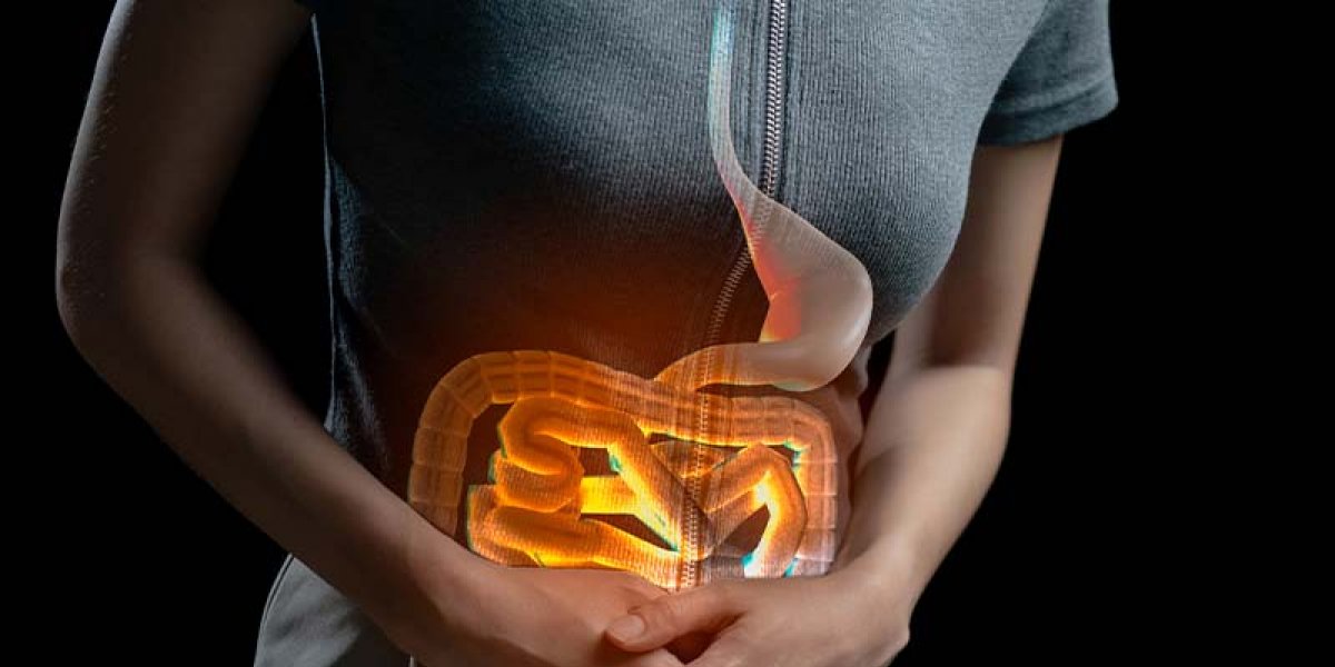 Síndrome de Dumping após cirurgia bariátrica: o que é, sintomas, diagnóstico e como prevenir