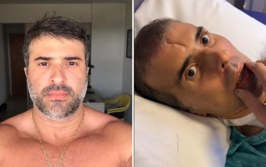 Após 9 meses internado, comandante atingido durante operação policial volta a falar