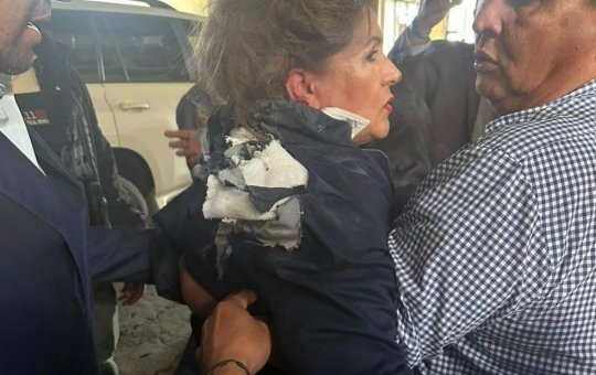 Deputada de Honduras é atingida por artefato explosivo durante entrevista