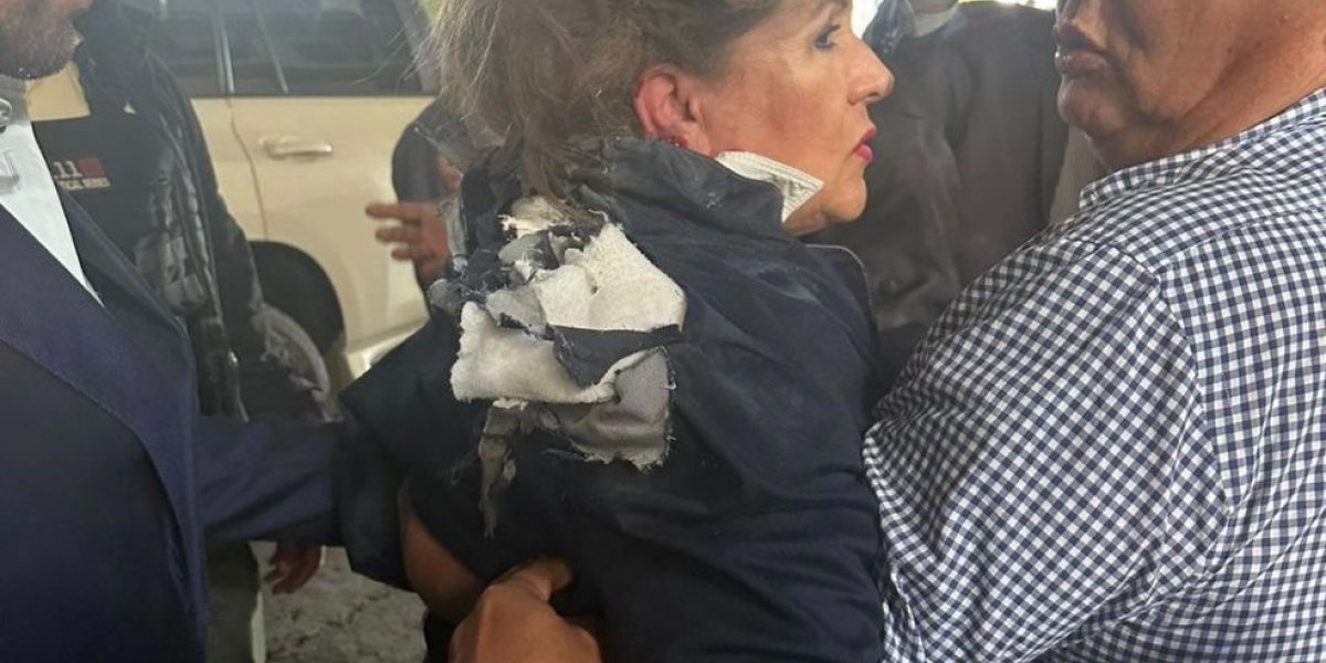 Deputada de Honduras é atingida por artefato explosivo durante entrevista