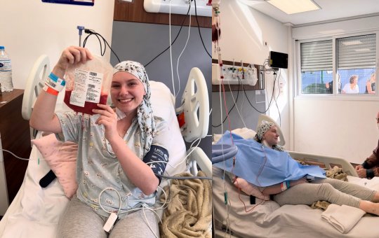 Saiba o que é o linfoma de Hodgkin, doença que vitimou Isabel Veloso