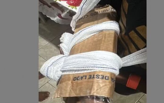 Criança sai de UPA com braço imobilizado com papelão após fratura no Rio de Janeiro