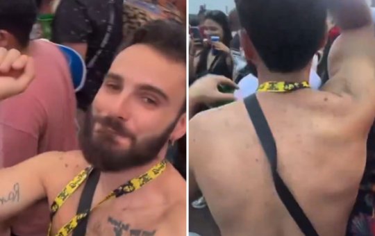 Funcionário de concessionária erra e posta vídeo curtindo show de Anitta em perfil da empresa