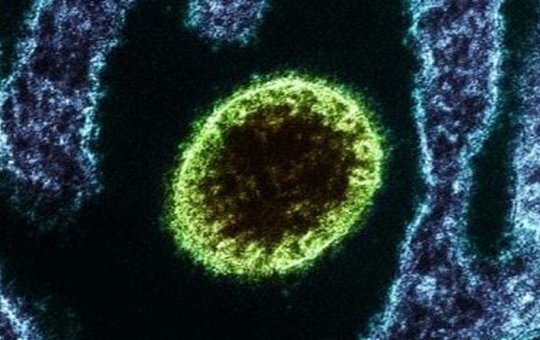 Índia confirma que 100 pessoas estão de quarentena graças ao vírus Nipah