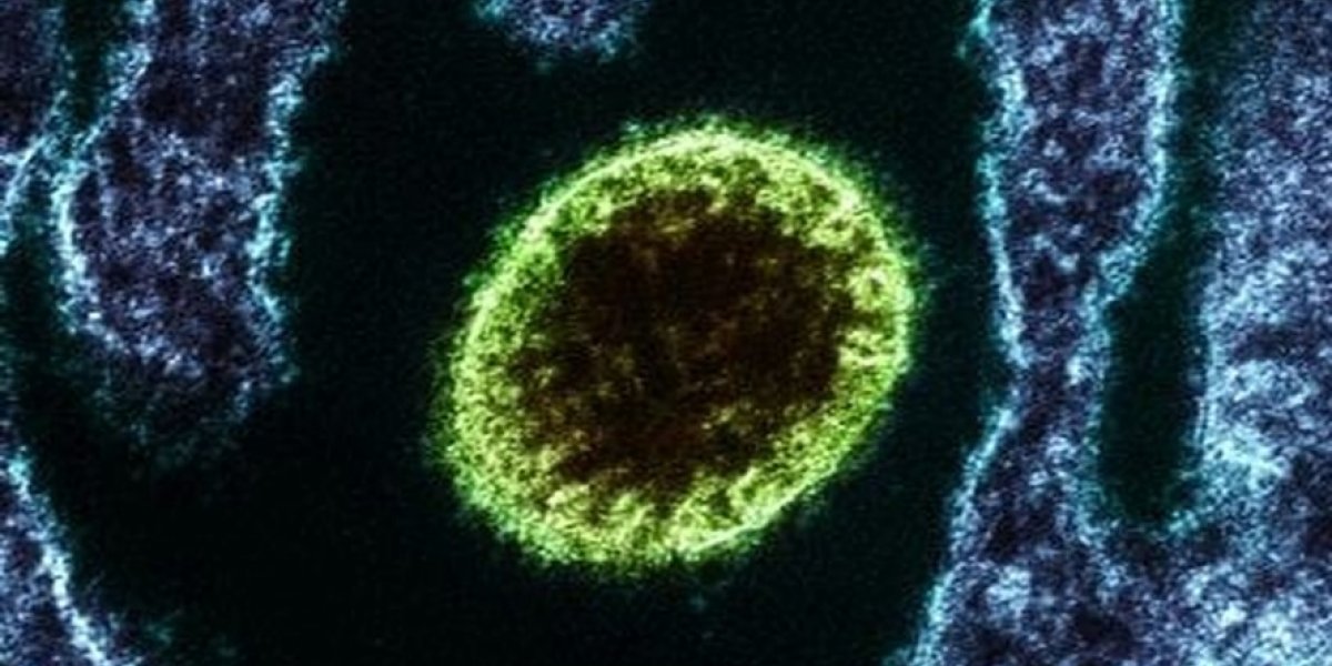 Índia confirma que 100 pessoas estão de quarentena graças ao vírus Nipah