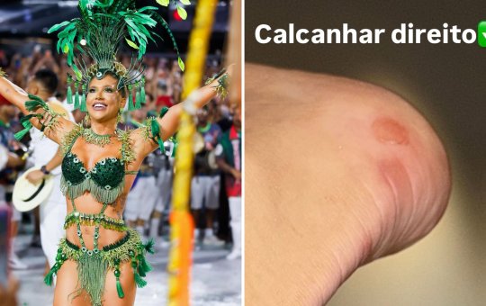 Após ensaio técnico da Sapucaí, Virginia mostra machucados e desabafa: 'Não consigo colocar o pé'