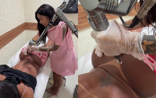 Gracyanne Barbosa inicia processo de retirada de tatuagem com o nome de Belo