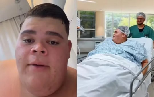 Gordão da XJ atualiza estado de saúde após cirurgia e relata infecção pós-operatória