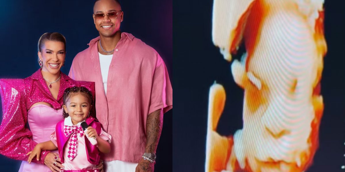 Lore Improta mostra rosto do filho em exame e encanta ao registrar reação de Liz