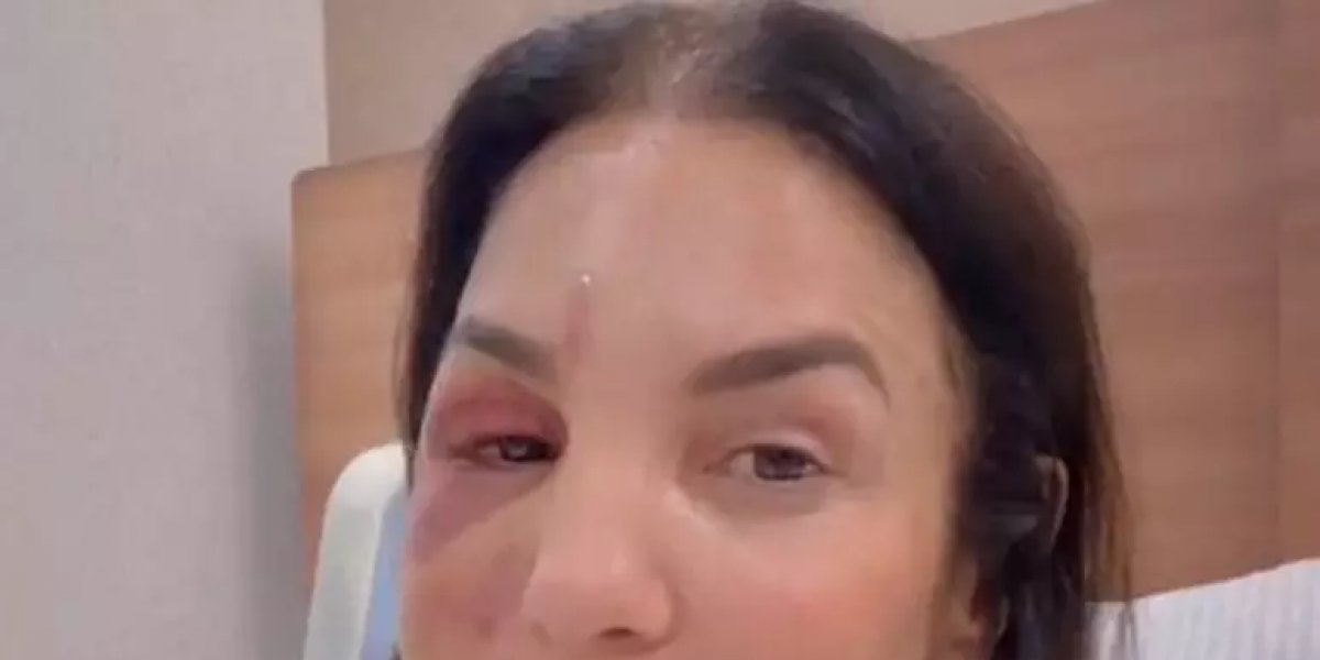 Ivete Sangalo em live no Instagram 