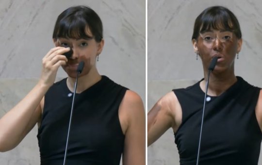 Deputada estadual Fabiana Bolsonaro (PL) se pinta de marrom em protesto contra mulheres trans. "Eu sou negra agora?"