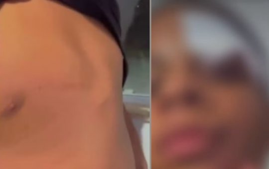 Estudante de 11 anos é agredido por colegas dentro de escola em Camaçari