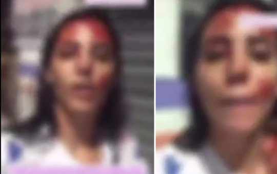 Jovem esfaqueia homem após agressão," Esse sangue não é meu, é dele!"