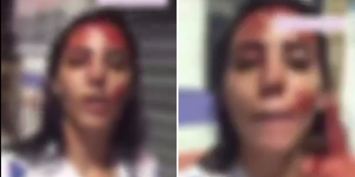 Jovem esfaqueia homem após agressão," Esse sangue não é meu, é dele!"