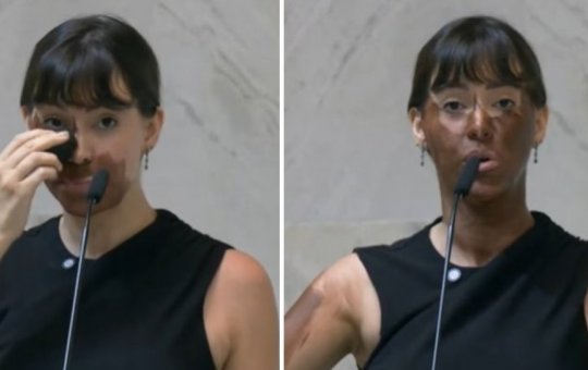 MPF determina abertura de inquérito para investigar deputada que se pintou de marrom durante sessão