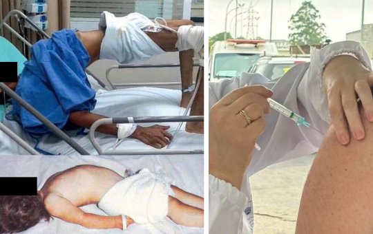 Médico posta Vídeo que alerta para sinal neurológico grave e viraliza nas redes