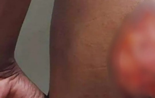 Jovem negro com deficiência auditiva é marcado com ferro no sudoeste da Bahia; irmãos são presos