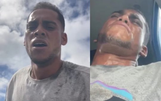 Blogueiro é baleado enquanto trabalhava no Acesso Norte, em Salvador