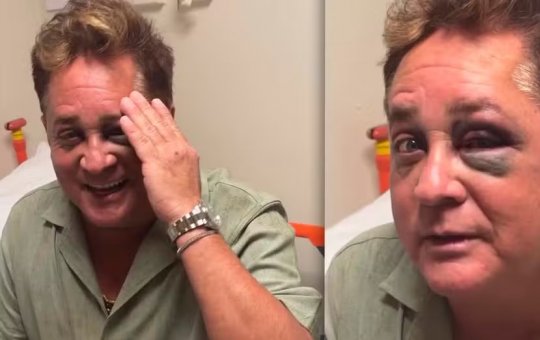 Leonardo sofre acidente durante pescaria e é atendido em hospital com olho roxo