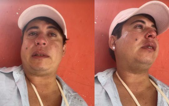 Cantor baiano denuncia agressão e diz ter braço quebrado durante show no interior
