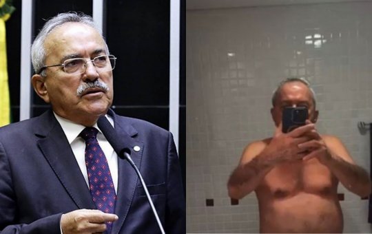 Ex-deputado bolsonarista posta nudes sem querer nas redes sociais
