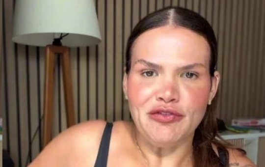 Thais Carla desabafa sobre flacidez após bariátrica: 'Ninguém te mostra o durante'