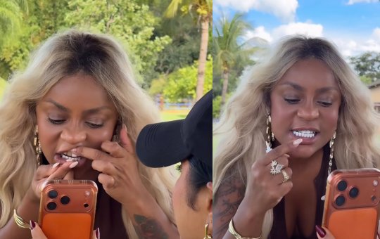 Cariúcha passa por perrengue ao quebrar lente dental e recorrer a improviso com cola instantânea