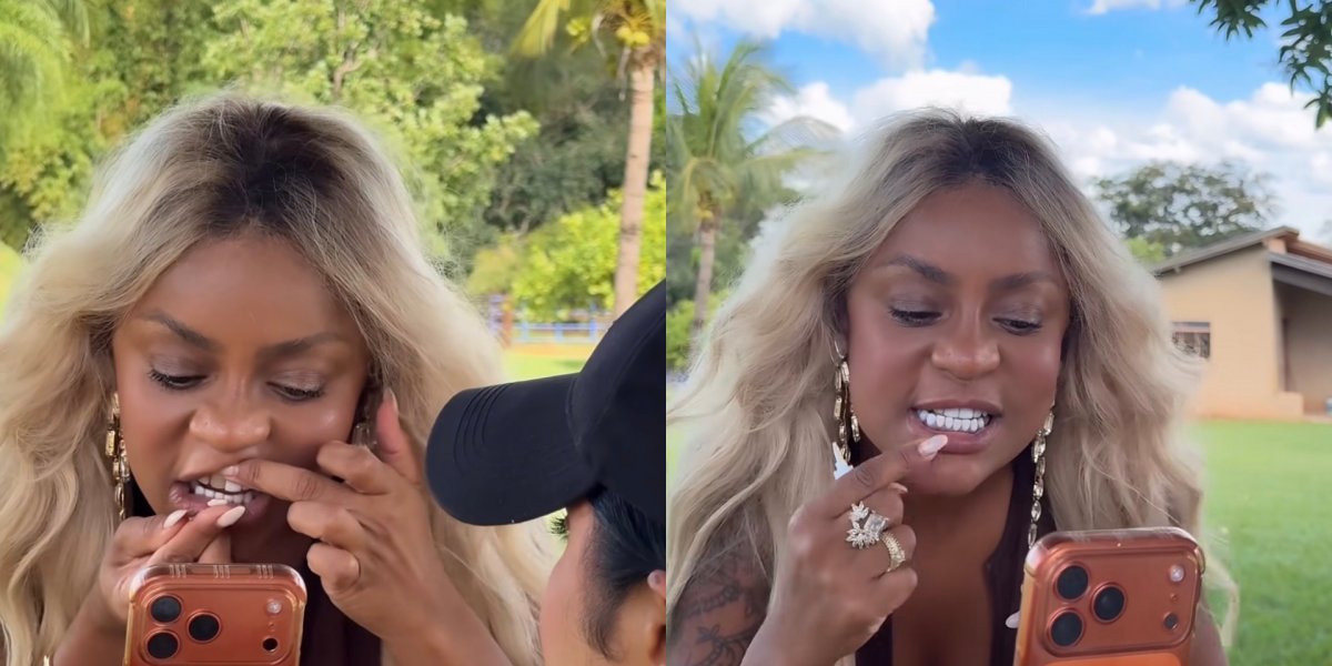 Cariúcha passa por perrengue ao quebrar lente dental e recorrer a improviso com cola instantânea