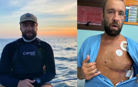 Surfista brasileiro é atingido no coração por peixe-espada durante sessão na Costa Rica