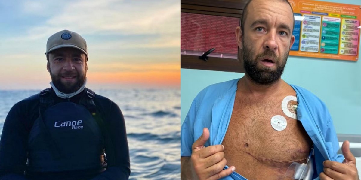 Surfista brasileiro é atingido no coração por peixe-espada durante sessão na Costa Rica