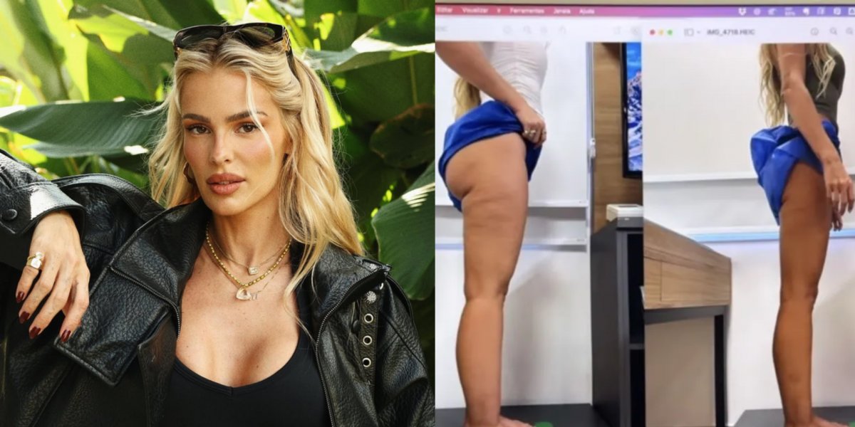 Yasmin Brunet conta como descobriu lipedema: "Um homem me parou na rua"