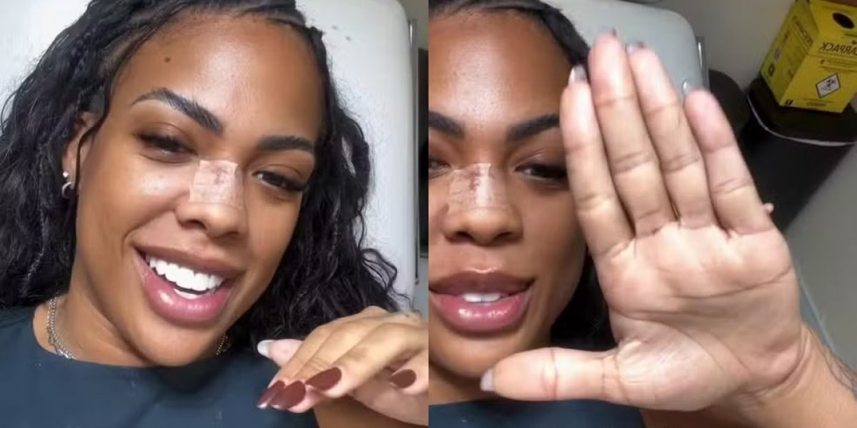 Ex-BBB Marvvila revela cirurgia para retirar sexto dedo: "Sempre tive vergonha"