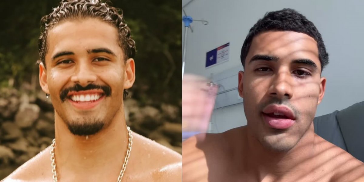 Cantor Nilo Froelich cancela shows após diagnostico de 'paralisia de Bell'