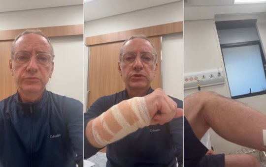 Jornalista da Globo é atacado por pitbull em passeio e precisa ser atendido em hospital