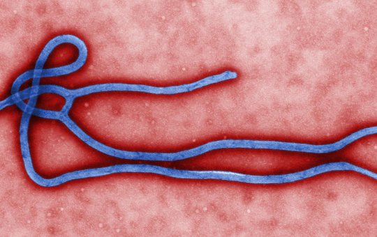 Secretária de Saúde de São Paulo descarta o segundo caso suspeito de infecção por ebola