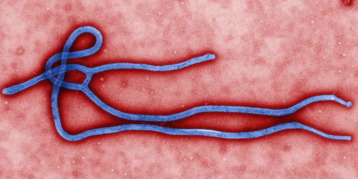 Secretária de Saúde de São Paulo descarta o segundo caso suspeito de infecção por ebola