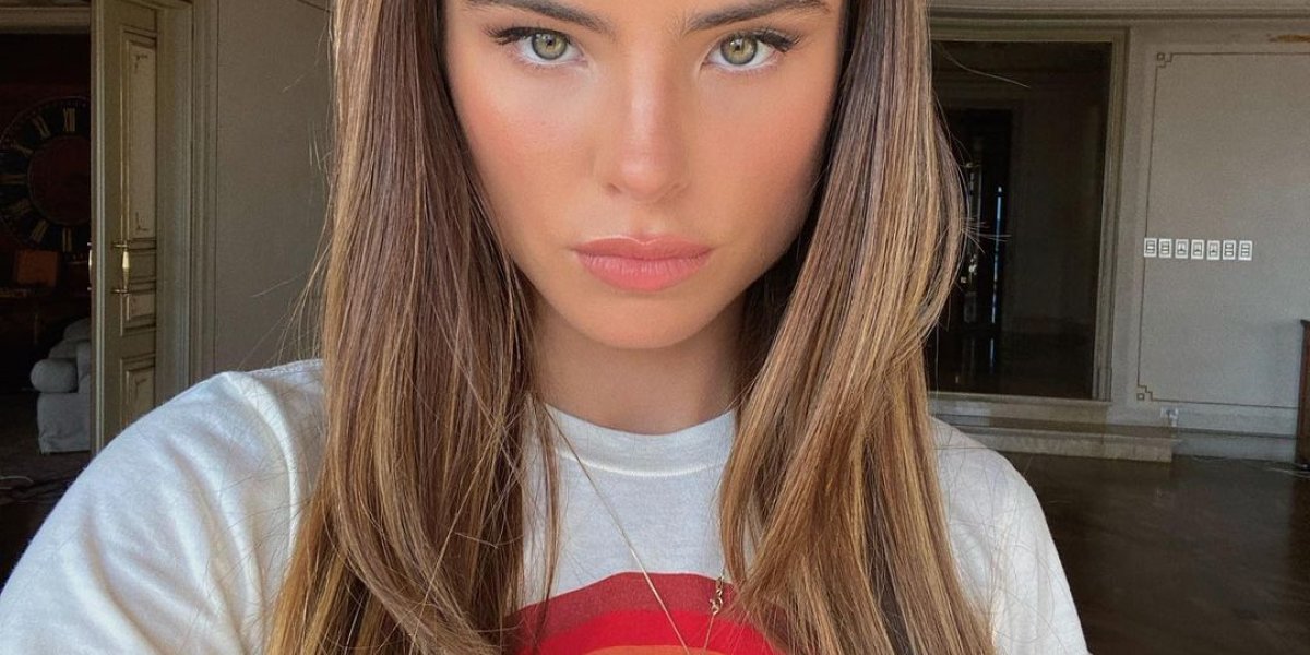 Giulia Be tem perda súbita de memória seguida por trauma cranioencefálico