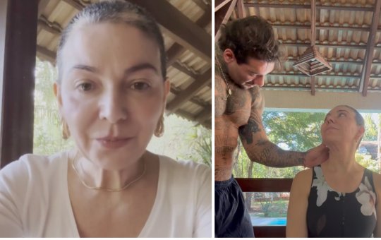 Mãe de Lucas Lucco revela retorno da alopecia e desabafa: "Sigo confiando no processo"