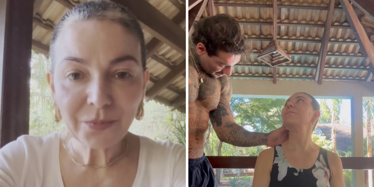 Mãe de Lucas Lucco revela retorno da alopecia e desabafa: "Sigo confiando no processo"