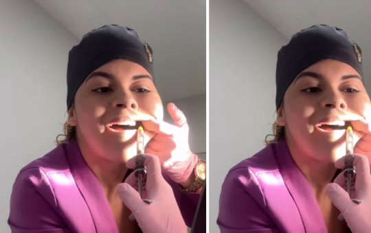 Dentista surpreende ao extrair o próprio dente do siso e viraliza nas redes