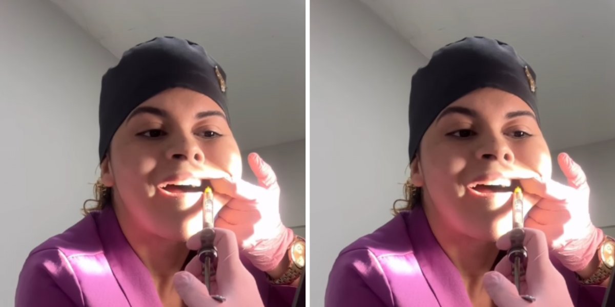 Dentista surpreende ao extrair o próprio dente do siso e viraliza nas redes