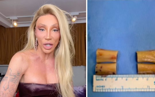 Maya Massafera revela o resultado da cirurgia de redução dos ombros