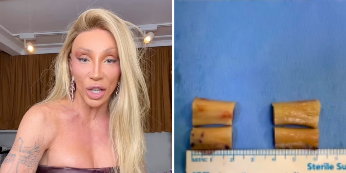 Maya Massafera revela o resultado da cirurgia de redução dos ombros