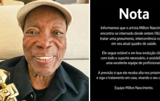 Milton Nascimento é internado para tratar pneumonia; quadro de saúde é estável