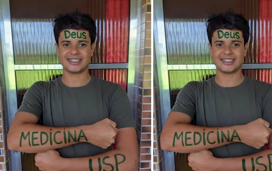 Baiano aprovado em 1º lugar em Medicina na USP é internado na UTI após complicações de cirurgia