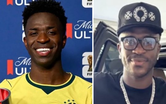 Vini Jr. faz harmonização facial e divide opiniões dos internautas