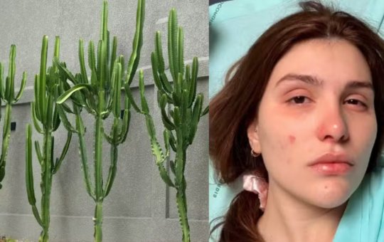 Influenciadora é internada após líquido de planta atingir os olhos: “Parecia soda cáustica”