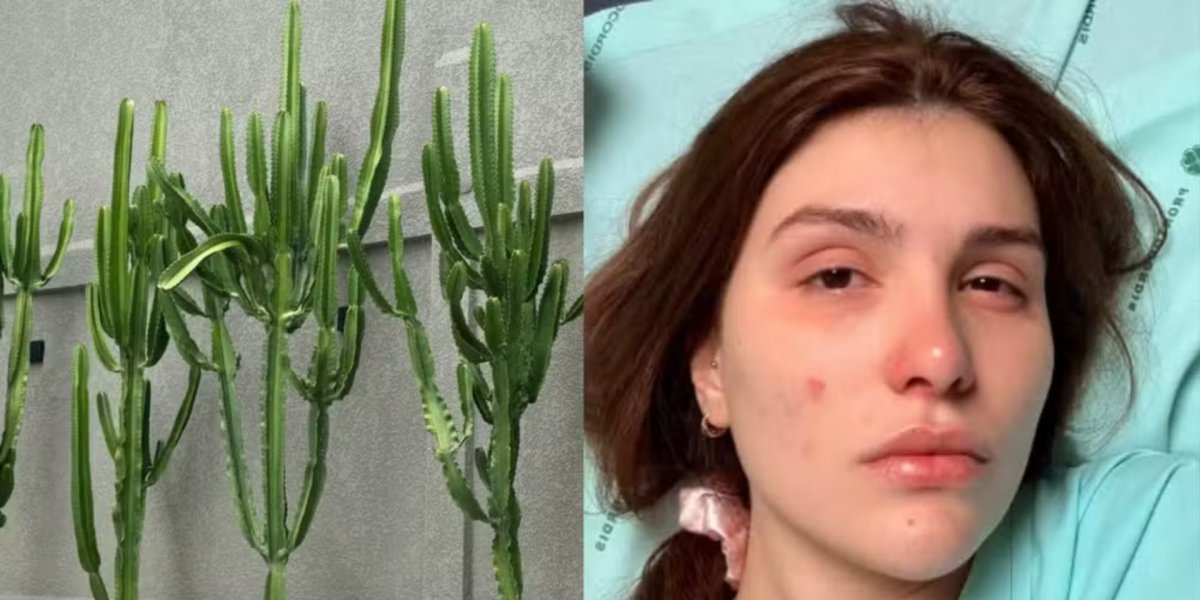 Influenciadora é internada após líquido de planta atingir os olhos: “Parecia soda cáustica”